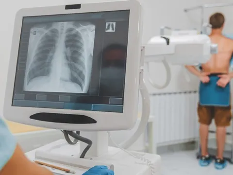 Chụp X-quang 'bấm là xong', sao phải chờ đủ 6 phút mới được BHYT thanh toán?