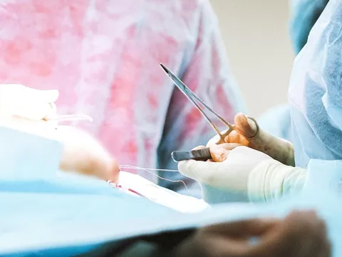 Ung thư có nên phẫu thuật không? Chuyên gia đính chính sai lầm về dao kéo