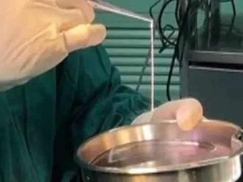 Người phụ nữ 32 tuổi đi ngoài ra sán dài tới 3 mét dù chưa từng ăn đồ sống, bác sĩ chỉ ra 1 thứ bếp nhà nào cũng có chính là thủ phạm