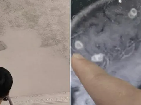 Bé gái 6 tuổi bị "đục" 20 lỗ ở não, suýt thành người thực vật: 5 góc khuất chứa đầy “chất độc vô hình” phải cẩn trọng khi dọn dẹp nhà đón Tết