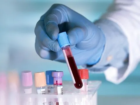 Xét nghiệm ung thư mới từ Mỹ có thể cứu nhiều người