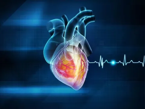 5 thói quen khiến trái tim ‘lâm nguy’, đột quỵ ‘chực chờ’: Nhiều người làm mỗi ngày mà không biết