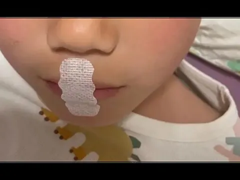 Bé trai 5 tuổi suýt thiếu oxy giữa đêm vì "bảo bối nuôi con" này: Tuyệt đối đừng dùng bừa bãi!