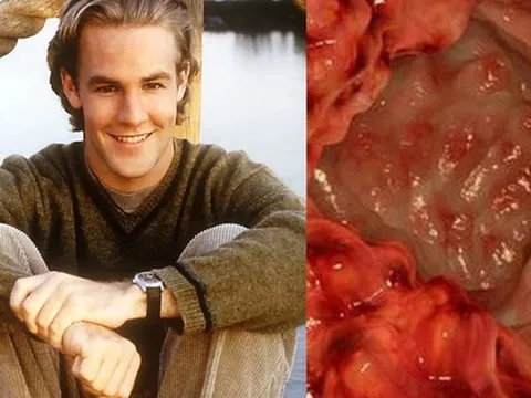 Sao phim "Ngã rẽ cuộc đời" qua đời ở tuổi 49 do ung thư: Bệnh đang trẻ hóa mức báo động, giới chuyên môn gần đây cảnh báo liên tục