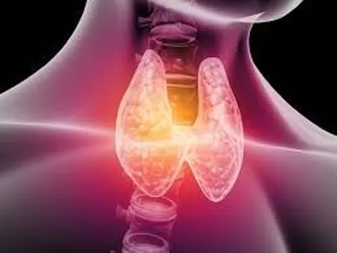 Nhiều người đi siêu âm phát hiện có nang giáp, bác sĩ chỉ ngay 5 dấu hiệu cảnh báo cần đi khám lại ngay lập tức