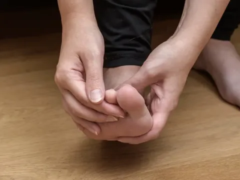 Gan "kêu cứu" bằng cách phát ra dấu hiệu này ở chân: Kiểm tra ngay xem bạn có không