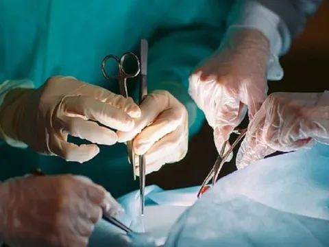 Túi thừa đại tràng 'phát nổ', bác sĩ cảnh báo biến chứng chết người