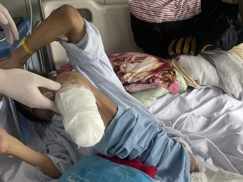 Người đàn ông hoại tử chân, viêm loét triền miên ở tuổi 62: Bác sĩ chỉ rõ 4 “thủ phạm” phá hủy mạch máu