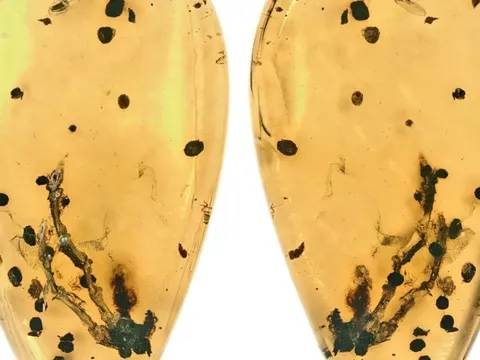 Hé lộ manh mối về nguồn gốc của bệnh u xương