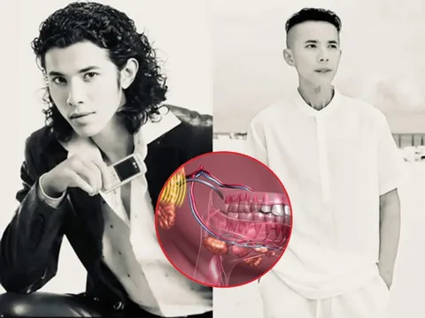 Kasim Hoàng Vũ qua đời vì 1 căn bệnh dễ bị bỏ qua: Triệu chứng ban đầu mờ nhạt, những ai cần đặc biệt cảnh giác?