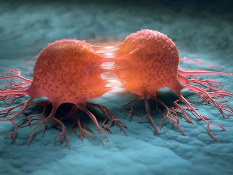 3 thói quen giúp "đẩy lùi" nguy cơ ung thư vùng miệng – hàm – mặt