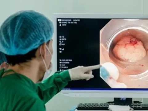 Sụt 5kg trong 1 tháng, người đàn ông 47 tuổi mắc cùng lúc 2 bệnh ung thư: Thủ phạm từ thói quen uống 300ml loại đồ uống này mỗi ngày