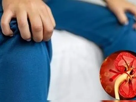 Muốn biết thận khỏe hay yếu, cứ nhìn vào tay và chân sẽ rõ: Có 7 dấu hiệu này thì phải đi khám sớm!