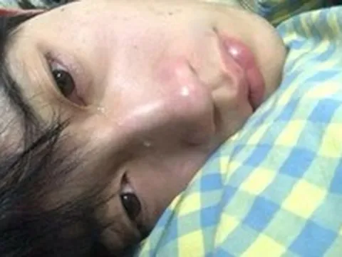 Bác sĩ nhắc nhở 6 triệu chứng phổ biến nhất của ung thư ruột: Tiếc là rất nhiều người bỏ qua, tưởng là… "ốm vặt"