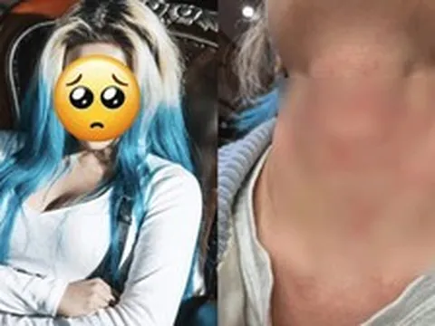 Nữ ca sĩ bị hành hung nghiêm trọng, còn bị ép viết thư xin lỗi