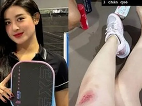 Á hậu Huyền My gặp tai nạn khi chơi pickleball