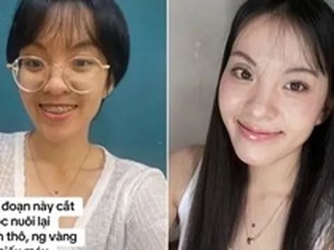 Màn thay đổi "đáng đồng tiền" của cô gái TP.HCM sau khi từ bỏ ăn thô, niềng răng và mổ mắt cận