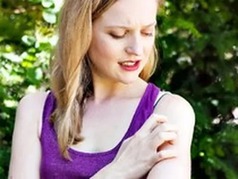 Câu nói 'người xinh đẹp thường thu hút muỗi' có hoàn toàn vô lý?