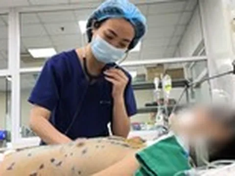 Cẩn trọng thủy đậu gây suy đa tạng, nguy hiểm tính mạng  ở người lớn