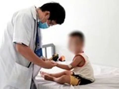 Số ca mắc tay chân miệng tại Khánh Hòa tăng gấp 4 lần, bước vào chu kỳ bùng phát
