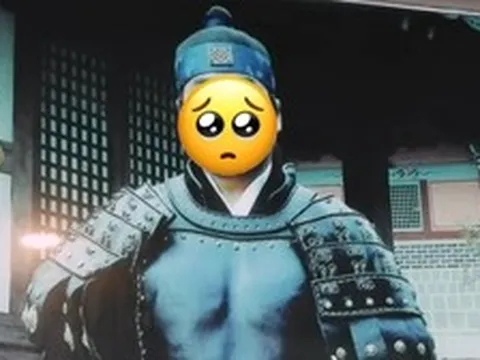 Sốc: Tài tử "Truyền Thuyết Jumong" mù mắt sau khi trượt chân ngã