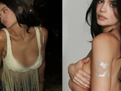 Tình hình của Kylie Jenner sau nghi vấn vỡ túi ngực ở Coachella