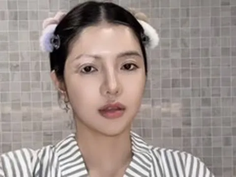 Mỹ nhân Việt mắc bệnh hiếm chỉ 2% dân số thế giới gặp phải