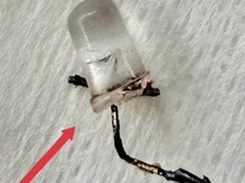 Bác sĩ thót tim gắp đèn LED nằm trong phế quản bé 9 tháng tuổi