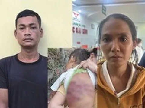 Bắt khẩn cấp đôi nhân tình hành hạ dã man bé trai 2 tuổi gây phẫn nộ dư luận ở TP.HCM