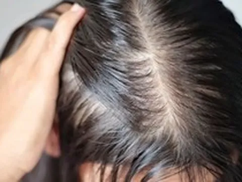 Lời khuyên cho những người hay bị rụng tóc