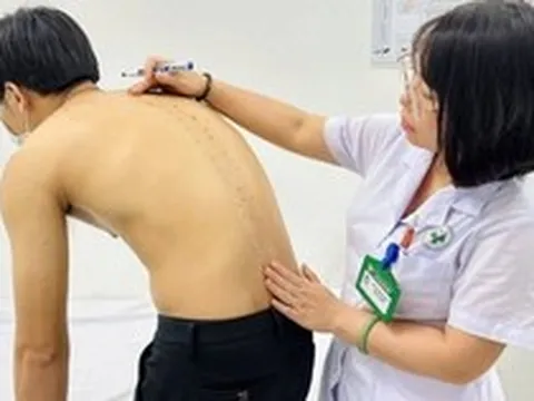 Thanh niên 20 tuổi đa u lưng âm ỉ suốt 6 tháng, bác sĩ chỉ rõ căn bệnh mạn tính nguy hiểm: Chủ quan dễ chịu khổ cả đời