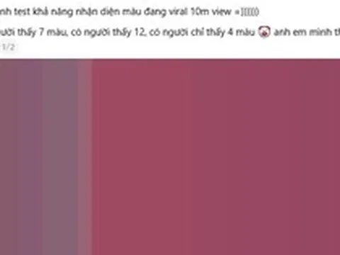 “Bức ảnh đếm màu đang viral với 10 triệu view”: Đáp án cuối cùng là gì?