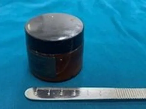 Cấp cứu nam bệnh nhân nhét hũ kem vào hậu môn