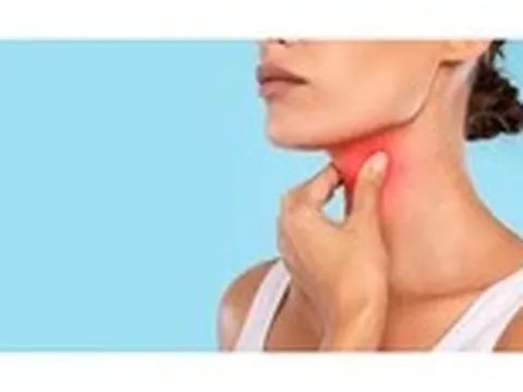 4 dấu hiệu ung thư amidan dễ bị bỏ qua