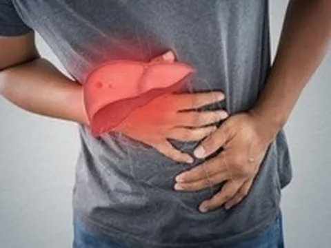 Khảo sát 422 bệnh nhân ung thư gan: Đều có 6 điểm chung này, không chỉ do rượu bia